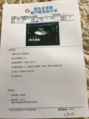 孕期彩超数据(刚刚给胎儿做了心脏彩超检查,结果的数据是多少标准的呢) 第1张 孕期彩超数据(刚刚给胎儿做了心脏彩超检查,结果的数据是多少标准的呢) 第1张