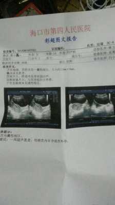 看懂孕期彩超（看懂孕期彩超要多久）  第2张
