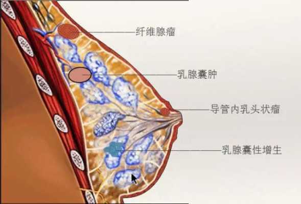 咳嗽会导致乳腺增生疼痛感加重么,孕期乳腺增生加重的原因 第1张 咳嗽会导致乳腺增生疼痛感加重么,孕期乳腺增生加重的原因 第1张