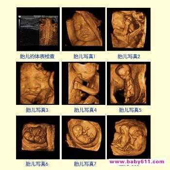 四维几周做是最佳时间,胎儿四维彩超几周做最佳时间 第2张 四维几周做是最佳时间,胎儿四维彩超几周做最佳时间 第2张