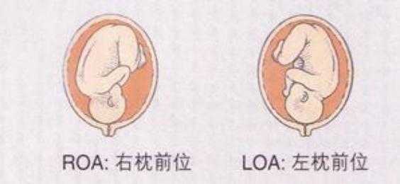 LOA是男孩还是女孩,胎儿头位loa图片 第2张 LOA是男孩还是女孩,胎儿头位loa图片 第2张