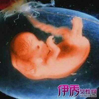 三个月胎儿图片有多大(那拍这个DR胸正位3个月的小孩辐射大吗) 第2张 三个月胎儿图片有多大(那拍这个DR胸正位3个月的小孩辐射大吗) 第2张