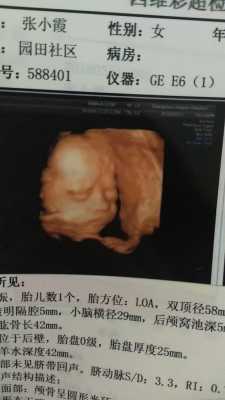 宝宝总皱眉怎么回事,胎儿皱眉头的四维  第2张