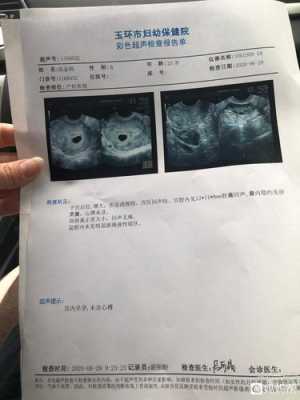婴儿会阴里很脏怎么清洗,胎儿阴超图片  第2张