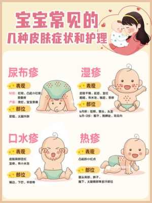 怀孕了长湿疹怎么办,孕期如何预防宝宝湿疹复发 第2张 怀孕了长湿疹怎么办,孕期如何预防宝宝湿疹复发 第2张