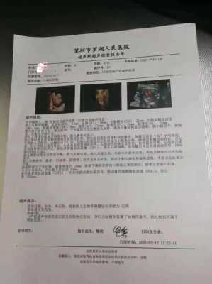 怀孕天数怎么算的?B超可以检测出,怀孕的天数吗,胎儿周期计算表 第2张 怀孕天数怎么算的?B超可以检测出,怀孕的天数吗,胎儿周期计算表 第2张