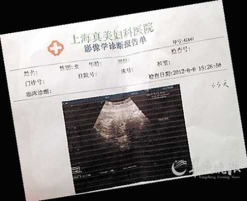 怀孕天数怎么算的?B超可以检测出,怀孕的天数吗,胎儿周期计算表 第1张 怀孕天数怎么算的?B超可以检测出,怀孕的天数吗,胎儿周期计算表 第1张