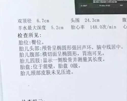 怀孕天数怎么算的?B超可以检测出,怀孕的天数吗,胎儿周期计算表 第3张 怀孕天数怎么算的?B超可以检测出,怀孕的天数吗,胎儿周期计算表 第3张