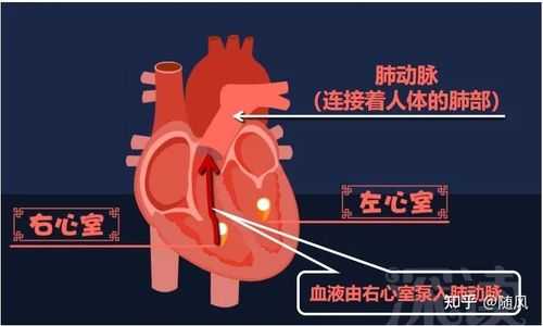 孕期肺动脉高压(孕期肺动脉高压是什么引起的) 第1张 孕期肺动脉高压(孕期肺动脉高压是什么引起的) 第1张