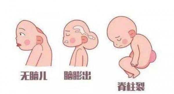 叶酸过多,会导致胎儿癫痫吗,胎儿羊癫疯的胎动特征 第1张 叶酸过多,会导致胎儿癫痫吗,胎儿羊癫疯的胎动特征 第1张