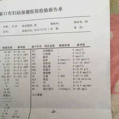 孕期尿检ph值7(反渗透进水ph值7个出水是多少) 第3张 孕期尿检ph值7(反渗透进水ph值7个出水是多少) 第3张