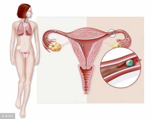 孕期宫内感染的症状(孕期宫内感染的症状) 第2张 孕期宫内感染的症状(孕期宫内感染的症状) 第2张