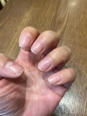 胎儿指甲划(胎儿指甲划子宫) 第3张 胎儿指甲划(胎儿指甲划子宫) 第3张