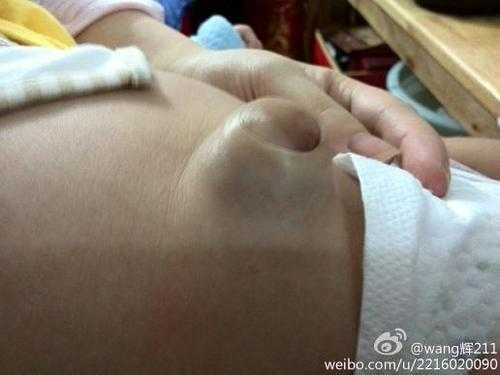 胎儿拱肚脐（胎儿拱肚脐眼怎么回事）  第1张