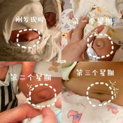 胎儿拱肚脐（胎儿拱肚脐眼怎么回事）  第3张