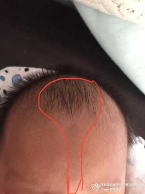 婴儿鼻梁高低怎么看,胎儿鼻梁低平 第2张 婴儿鼻梁高低怎么看,胎儿鼻梁低平 第2张