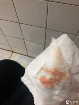 尿路感染有血很严重吗,尿路感染出血怎么回事,孕期尿路感染出血对胎儿有影响吗 第1张 尿路感染有血很严重吗,尿路感染出血怎么回事,孕期尿路感染出血对胎儿有影响吗 第1张