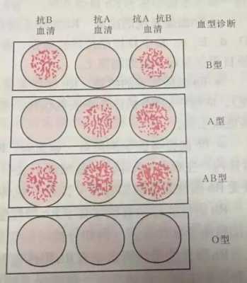 检测胎儿血型(孕期产检会对血型进行检查吗?一直都不知道自己是什么血型的,或者我可以自己处理呀) 第2张 检测胎儿血型(孕期产检会对血型进行检查吗?一直都不知道自己是什么血型的,或者我可以自己处理呀) 第2张