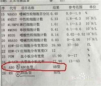 检测胎儿血型(孕期产检会对血型进行检查吗?一直都不知道自己是什么血型的,或者我可以自己处理呀) 第3张 检测胎儿血型(孕期产检会对血型进行检查吗?一直都不知道自己是什么血型的,或者我可以自己处理呀) 第3张