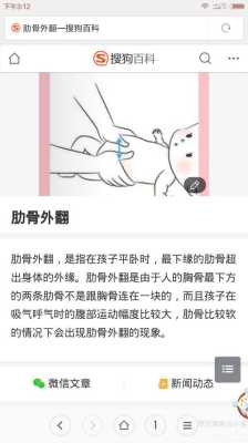 婴儿肋骨外翻怎么办,胎儿肋骨长标准  第2张