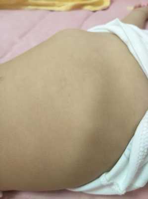婴儿肋骨外翻怎么办,胎儿肋骨长标准  第1张