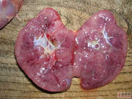 胎儿肾组织(胎儿肾脏) 第2张 胎儿肾组织(胎儿肾脏) 第2张