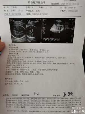 胎儿胆囊下(我怀孕36周+4天了检查的胎儿胆囊大小约28.7*8.2mm正常吗) 第2张 胎儿胆囊下(我怀孕36周+4天了检查的胎儿胆囊大小约28.7*8.2mm正常吗) 第2张