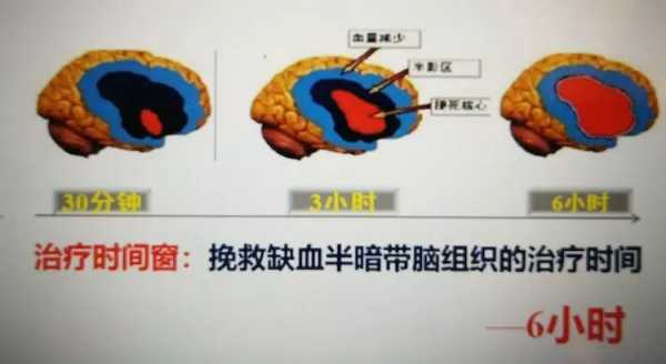 儿童缺血灶怎么办,胎儿脑缺血是什么导致的 第2张 儿童缺血灶怎么办,胎儿脑缺血是什么导致的 第2张