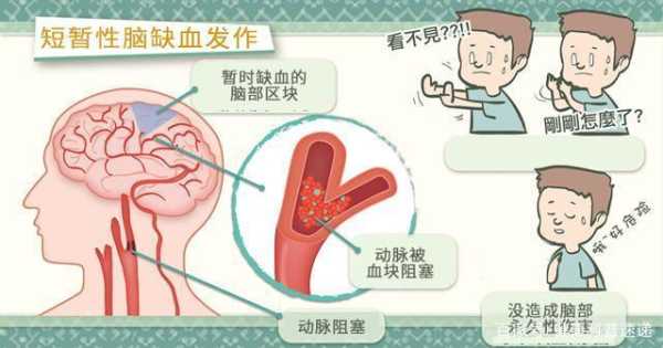 儿童缺血灶怎么办,胎儿脑缺血是什么导致的 第1张 儿童缺血灶怎么办,胎儿脑缺血是什么导致的 第1张