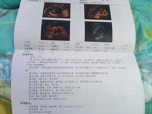 脑中线居中是什么意思啊,胎儿脑中线居中是什么意思 第2张 脑中线居中是什么意思啊,胎儿脑中线居中是什么意思 第2张