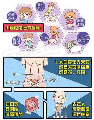 孕期疝气怎么办(疝气是怎么引起的孕妇) 第3张 孕期疝气怎么办(疝气是怎么引起的孕妇) 第3张