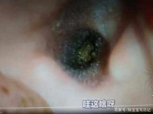 孕期手电照宝宝瞎(孕期手电照胎儿瞎) 第3张 孕期手电照宝宝瞎(孕期手电照胎儿瞎) 第3张