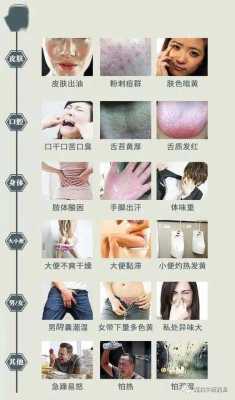 孕期湿气太重怎么除(孕期湿气太重怎么除湿) 第1张 孕期湿气太重怎么除(孕期湿气太重怎么除湿) 第1张
