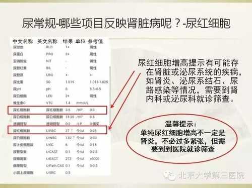 细菌感染,血象高是什么原因,孕期尿常规细菌偏高怎么办 第2张 细菌感染,血象高是什么原因,孕期尿常规细菌偏高怎么办 第2张