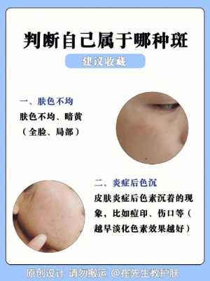 孕期怎样预防长斑(孕期怎样预防长斑长痣) 第2张 孕期怎样预防长斑(孕期怎样预防长斑长痣) 第2张