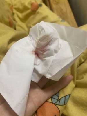 孕期鼻子出血正常吗(为什么孕晚期鼻子容易出血) 第2张 孕期鼻子出血正常吗(为什么孕晚期鼻子容易出血) 第2张