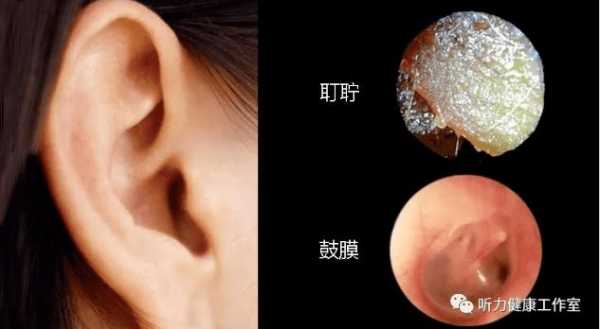 孕期流黑色分泌物(孕期流黑色分泌物图片) 第2张 孕期流黑色分泌物(孕期流黑色分泌物图片) 第2张