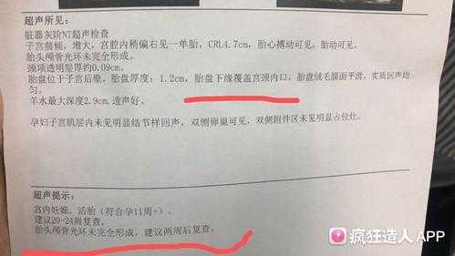 胎儿未见颅骨光环(胎儿未见颅骨光环) 第2张 胎儿未见颅骨光环(胎儿未见颅骨光环) 第2张