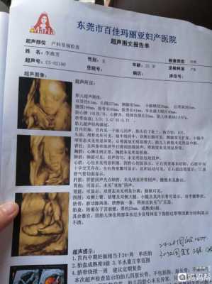 胎儿大排畸检查(大排畸多少周可以做) 第1张 胎儿大排畸检查(大排畸多少周可以做) 第1张