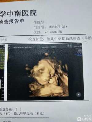 胎儿大排畸检查(大排畸多少周可以做) 第2张 胎儿大排畸检查(大排畸多少周可以做) 第2张