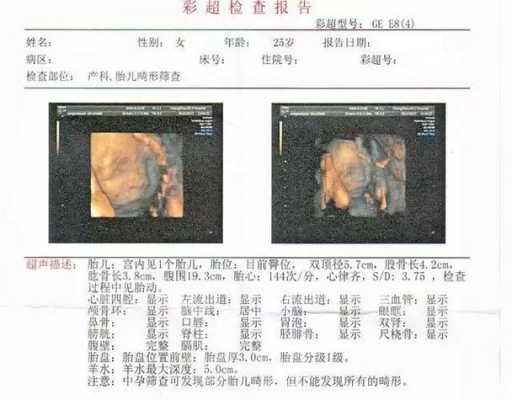 胎儿彩超CM(胎儿彩超cm是什么意思) 第2张 胎儿彩超CM(胎儿彩超cm是什么意思) 第2张