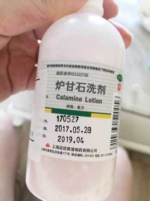 孕期经常湿疹怎么办(怀孕以后身上长了许多湿疹,可以涂什么药膏) 第1张 孕期经常湿疹怎么办(怀孕以后身上长了许多湿疹,可以涂什么药膏) 第1张