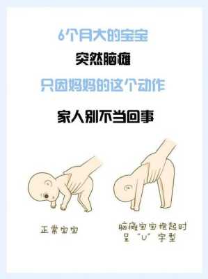 脑瘫儿在孕期的表现(脑瘫儿在孕期的表现有哪些) 第1张 脑瘫儿在孕期的表现(脑瘫儿在孕期的表现有哪些) 第1张