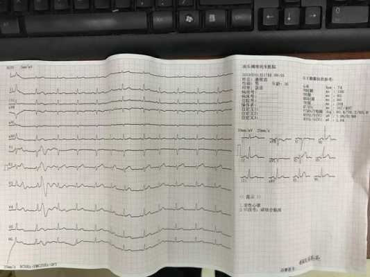 孕期心电图什么时候做(孕妇做心电图夹哪里的啊?怀孕两个多月了的) 第2张 孕期心电图什么时候做(孕妇做心电图夹哪里的啊?怀孕两个多月了的) 第2张