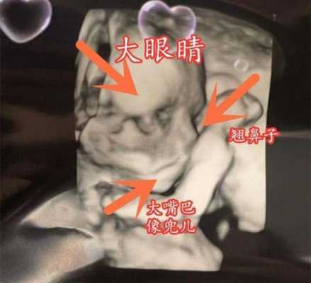 胎儿偏大是男孩吗(胎儿偏大是男孩吗?) 第1张 胎儿偏大是男孩吗(胎儿偏大是男孩吗?) 第1张