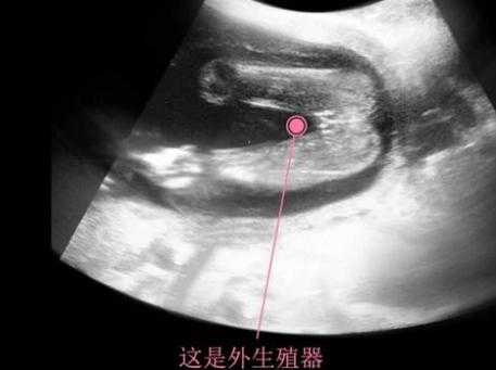 怀孕4月胎儿图片(怀孕4月胎儿图片大全) 第3张 怀孕4月胎儿图片(怀孕4月胎儿图片大全) 第3张