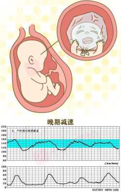 胎儿心跳能摸到吗(胎儿心跳可以摸到吗) 第2张 胎儿心跳能摸到吗(胎儿心跳可以摸到吗) 第2张