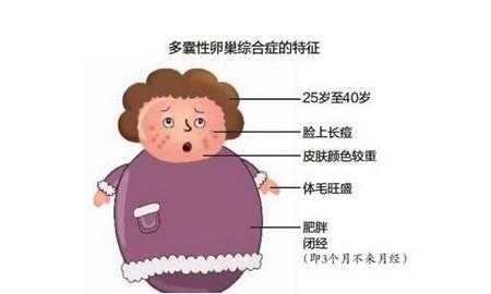 胎儿雄性激素(胎儿雄性激素高是怎么造成的) 第2张 胎儿雄性激素(胎儿雄性激素高是怎么造成的) 第2张