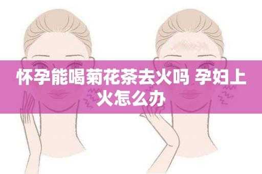 孕妇上火严重怎么办,孕期上火可以喝菊花吗  第1张