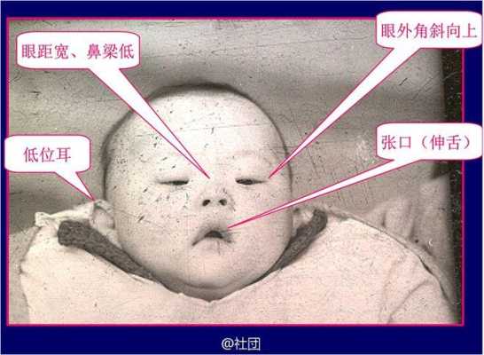 胎儿能查出弱智吗(怎么才能知道宝宝的智力是否正常) 第2张 胎儿能查出弱智吗(怎么才能知道宝宝的智力是否正常) 第2张